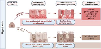 How early life respiratory viral infections impact airway epithelial development and may lead to asthma